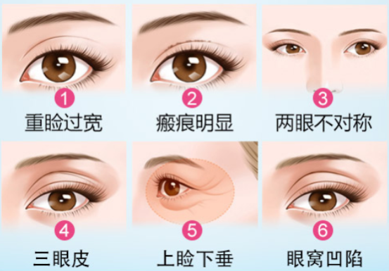 QQ؈D20180502110808.png