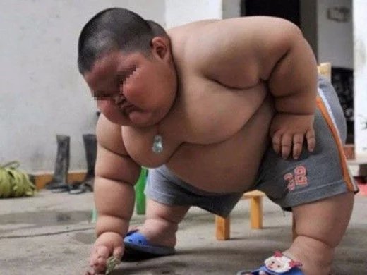 \